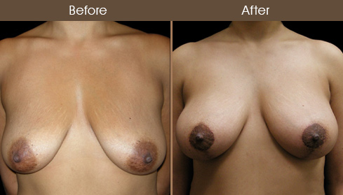 20202705173126_B32-Front